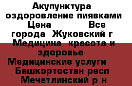 Акупунктура, оздоровление пиявками › Цена ­ 3 000 - Все города, Жуковский г. Медицина, красота и здоровье » Медицинские услуги   . Башкортостан респ.,Мечетлинский р-н